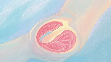 乳腺癌：隐形的健康威胁，你该如何应对？