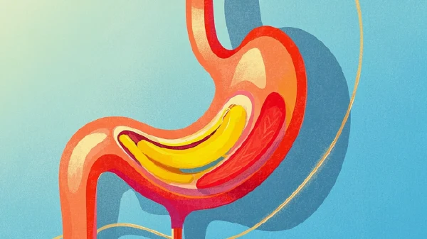 萎缩性胃炎:早期信号与科学应对指南