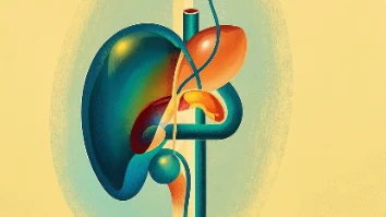 胆囊结石手术麻醉:确保安全与顺利恢复的关键