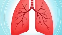 突破绝境:IV期肺恶性肿瘤治疗指南的全景探讨