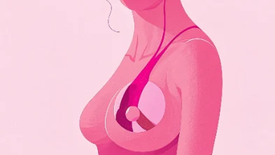 浸润性导管癌:女性必知的健康警告和预防措施