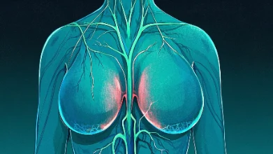 乳腺癌:识别信号与精准治疗方案