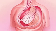 破坏静谧世界的恶客——要警惕!乳腺癌不再遥远!