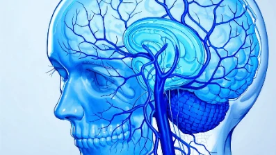颅内动脉瘤破裂伴蛛网膜下腔出血的全面解析