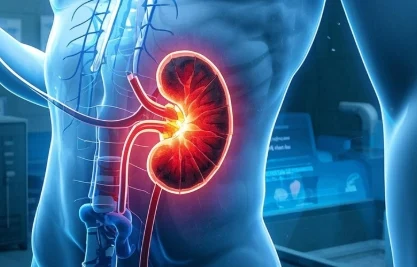 肾结石:隐匿的“腹痛谋士”,你了解多少?