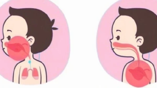 感冒也能要命?了解急性上呼吸道感染及其伴随疾病的重要性!